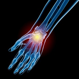 hand-and-wrist-injuries