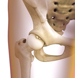 hip-synovitis