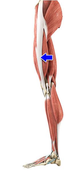 Iliotibial Band Syndrome