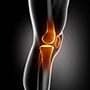 Knee Ligament Reconstruction